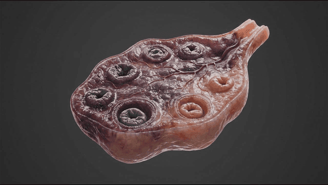 Detailed view of ovarian structure infected by virus