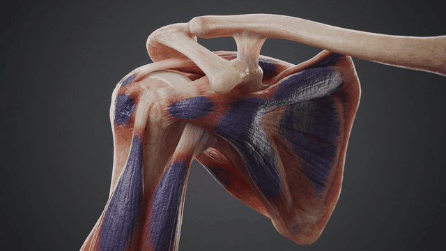 Detailed view of infected shoulder muscles and bones