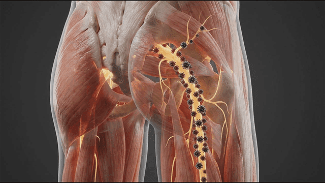 Detailed view of human leg muscles and nerves where germs spread