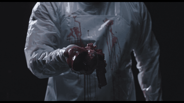 심장을 꺼내는 수술